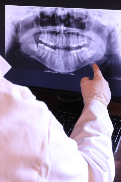 Best Emergency Dentist for Lost Fillings or Crowns in Solon, OH